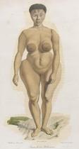 Female figure